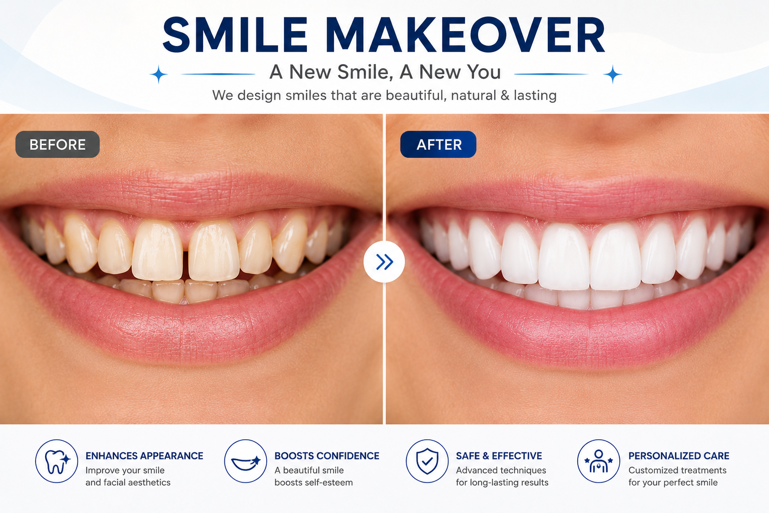 Before and after smile makeover result